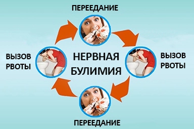 Лечение булимии в Роговской